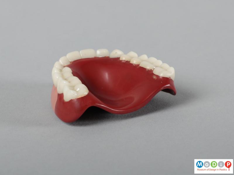 Side view of a upper denture showing the denture base.