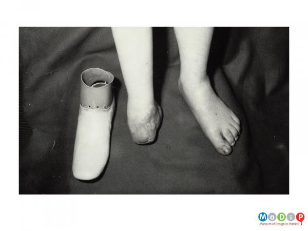 Scanned image showing an artificial foot.