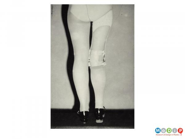 Scanned image showing a woman wearing a leg calliper.